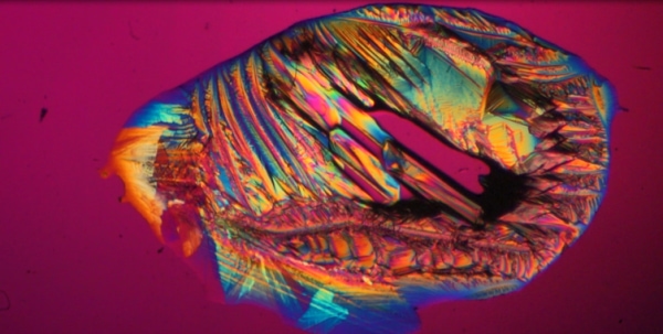 Epson Salt. Recrystallization of magnesium sulfate, a compound with medical uses as a laxative and a soaking solution to relieve muscle and joint soreness.  Polarized light microscopy.  Image by Albert Wang, Monta Vista High School, Cupertino, CA