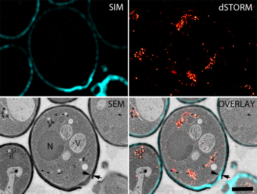 X14 - Biological EM Sample Processing: From 2D to 3D