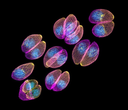 X61 — Atom Probe Tomography User's Meeting and Workshop Professionals in Microscopy and Microanalysis